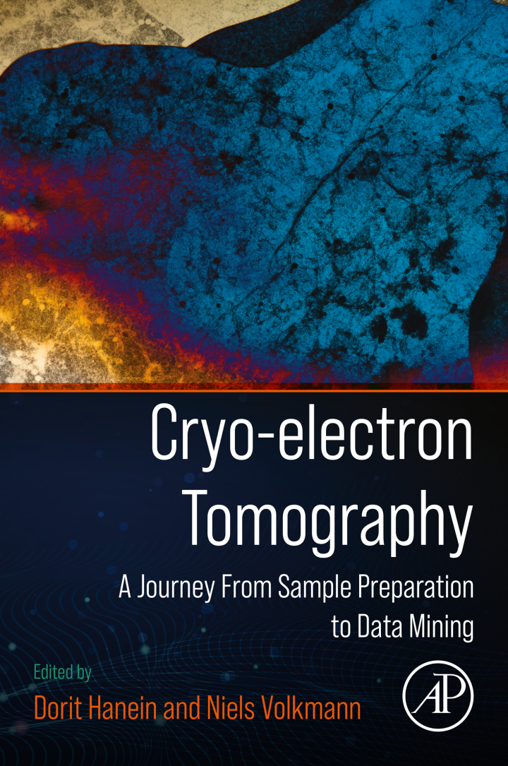 Cryo-electron Tomography: A Journey from Sample Preparation to Data Mining