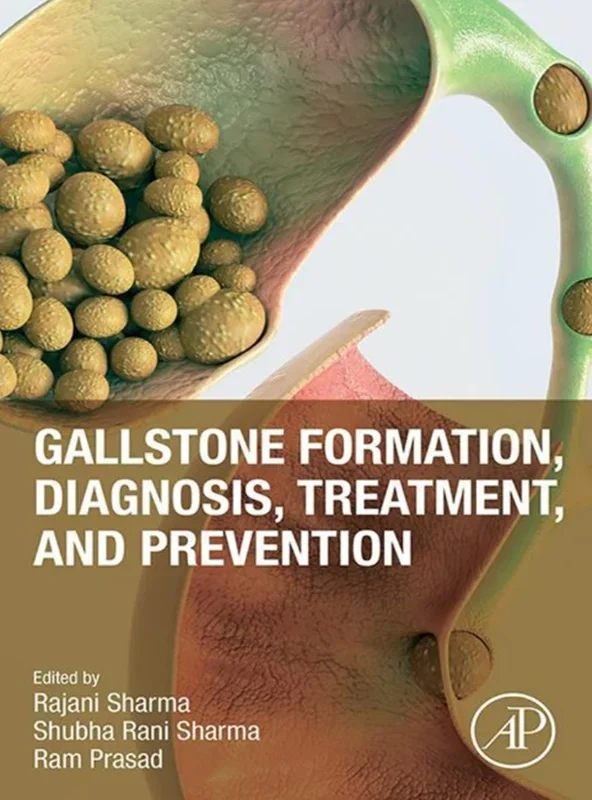 Gallstone Formation, Diagnosis, Treatment and Prevention